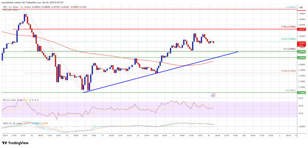 XRP Price Surge - Approaching Resistance Level, Next Trend Decision imminent